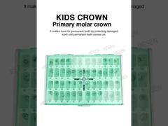 Een nadere blik: KIDS CROWN Primaire molaarkroon